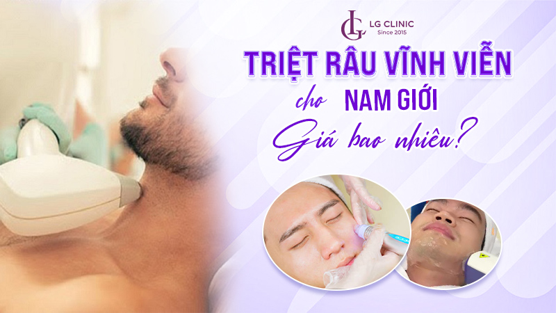 Triệt râu vĩnh viễn giá bao nhiêu