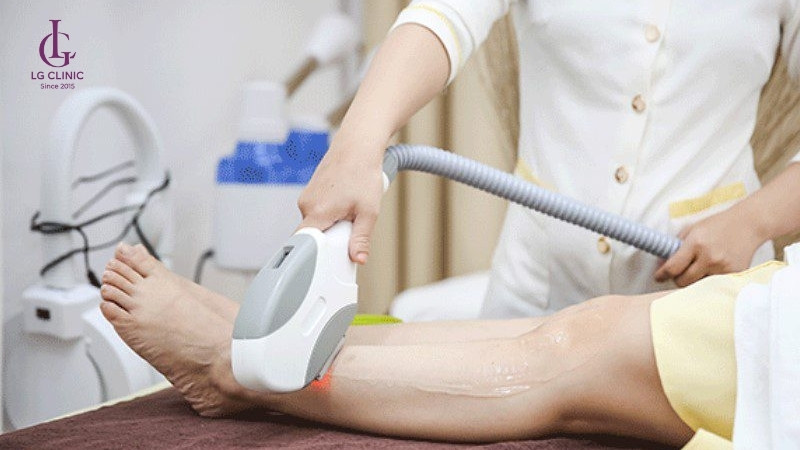 Ưu nhược điểm khi triệt lông OPT bằng ánh sáng hiện đại.