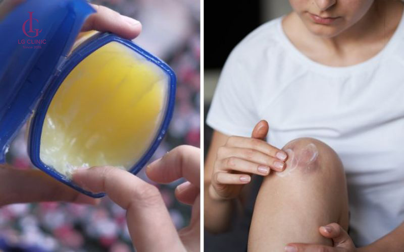 Vaseline nguyên chất