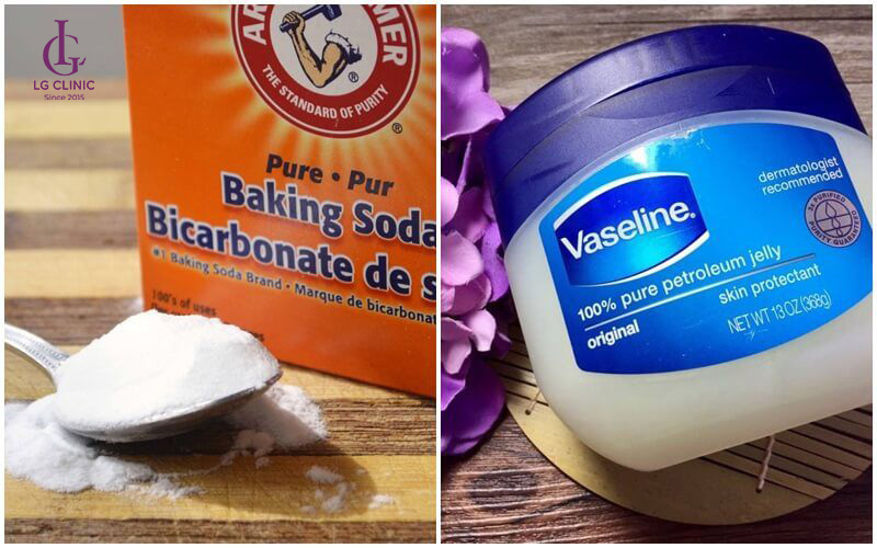 Vaseline và Baking soda