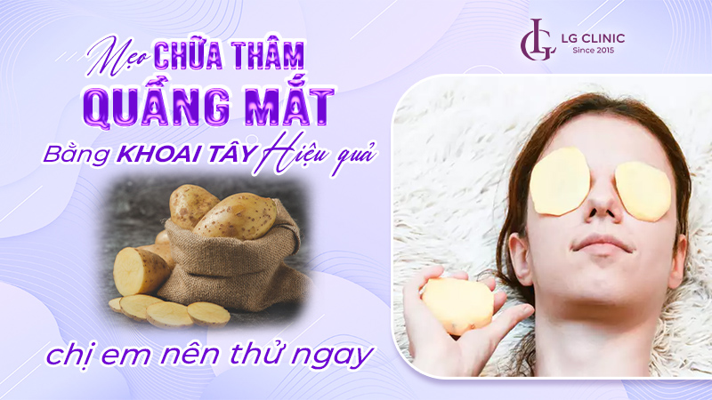 Cách chữa thâm quầng mắt bằng khoai tây