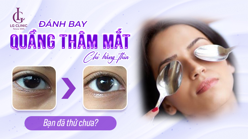 Cách làm giảm thâm quầng mắt bằng thìa