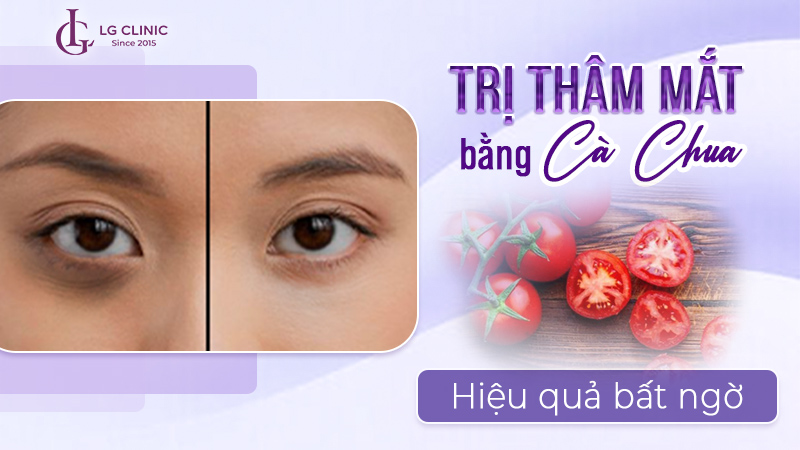 Cách trị thâm mắt bằng cà chua