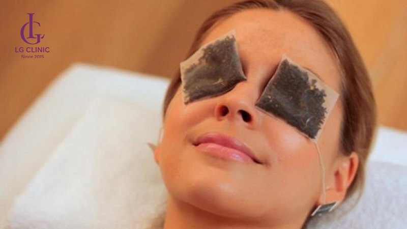 Đắp túi trà trị thâm mắt tại nhà