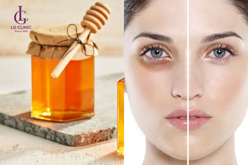 Mật ong trị thâm quầng mắt