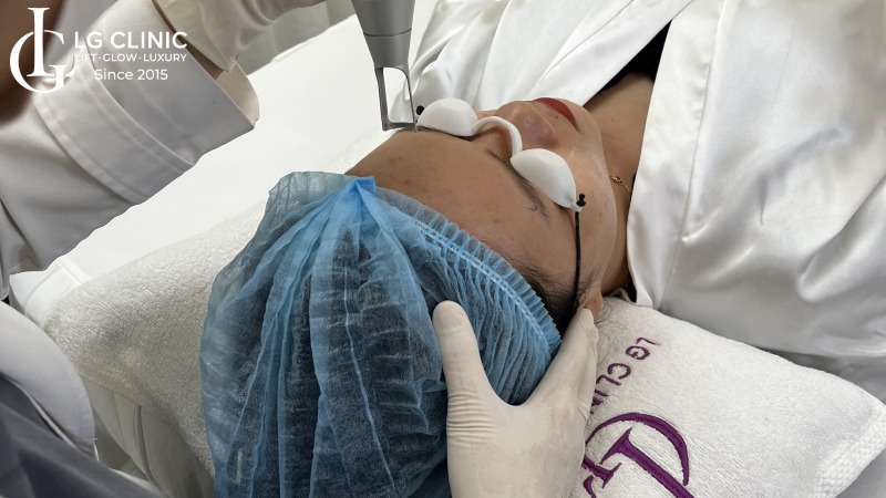 Lăn kim trị thâm mụn có tốt không