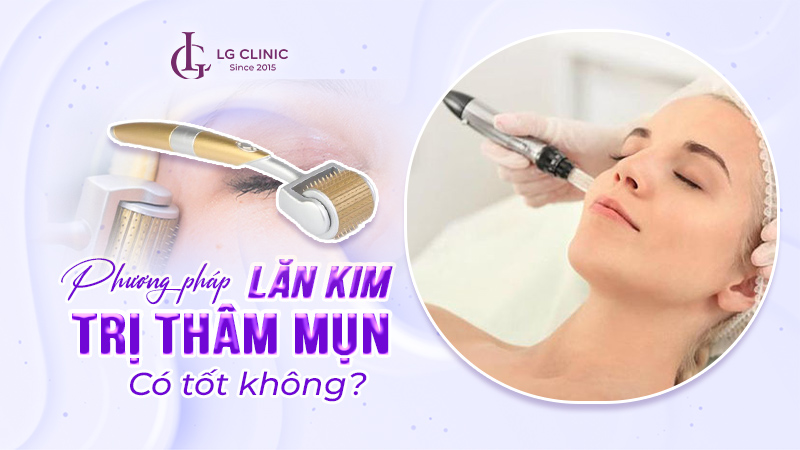 Lăn kim trị thâm mụn có tốt không