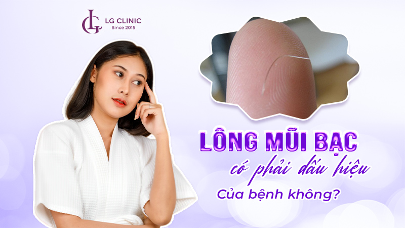 Lông mũi bạc