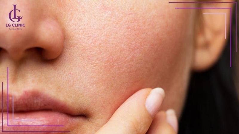 Lông trắng mọc 1 sợi trên má