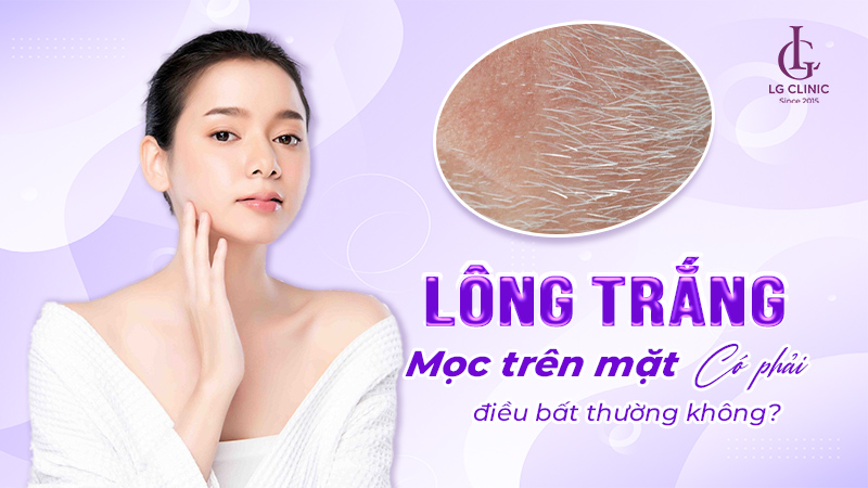 Lông trắng mọc trên mặt