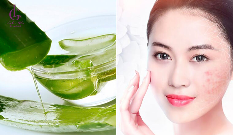 Nha đam trị mụn thâm tụ máu