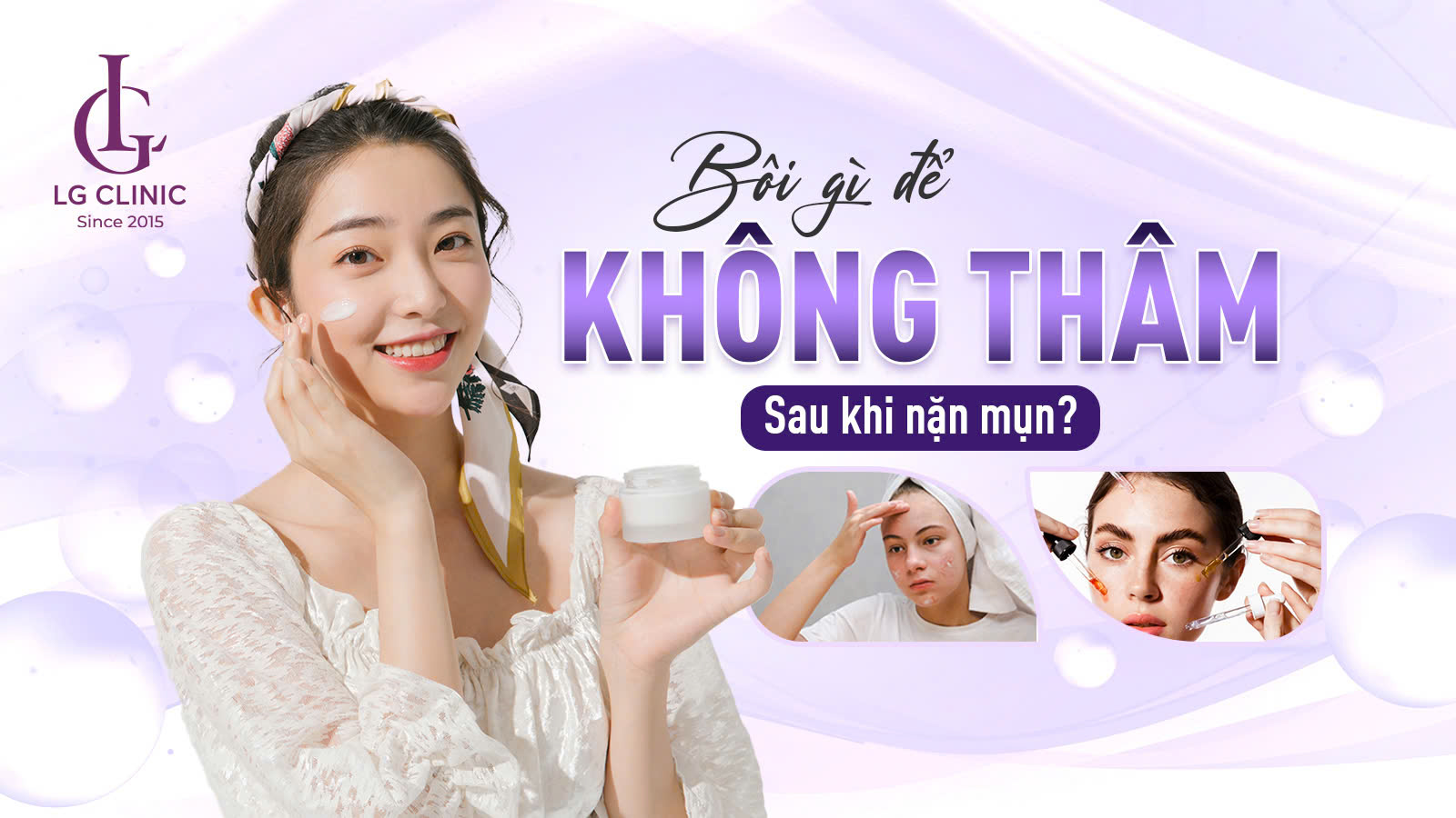 nặn mụn xong nên làm gì và bôi gì để không thâm