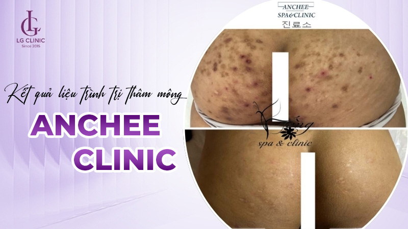 Anchee Clinic