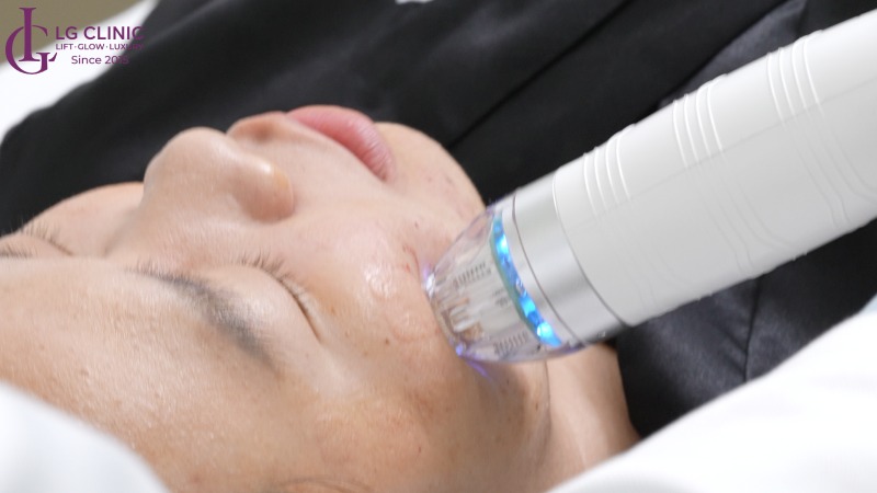 tại sao thâm mụn không hết
