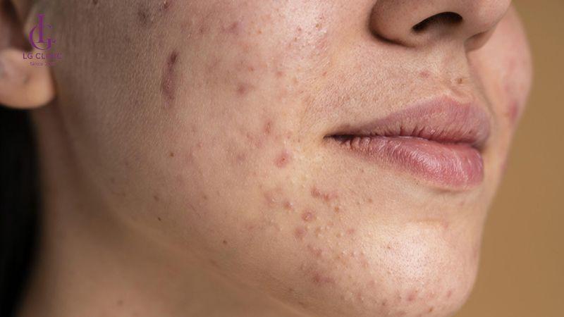 Da tiếp xúc nhiều với ánh nắng mặt trời