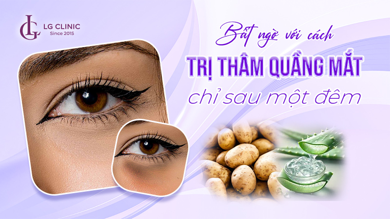 Trị thâm quầng mắt sau 1 đêm
