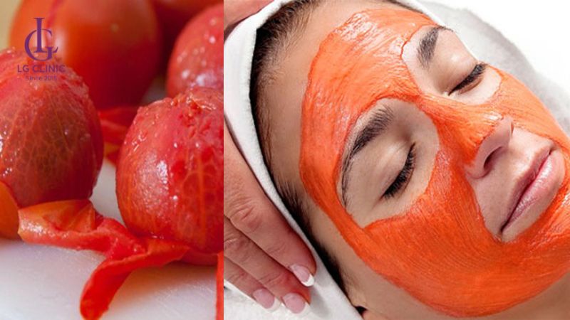 mặt nạ cà chua trị mụn thâm