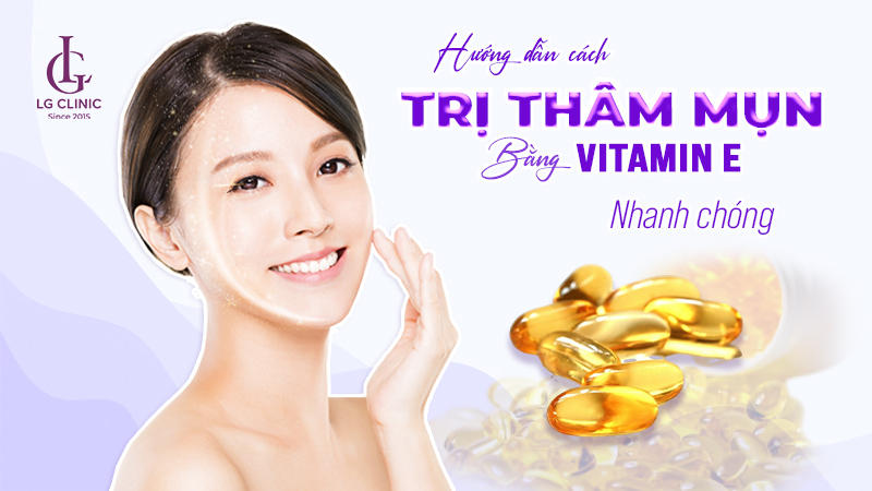 Cách trị thâm mụn bằng vitamin E