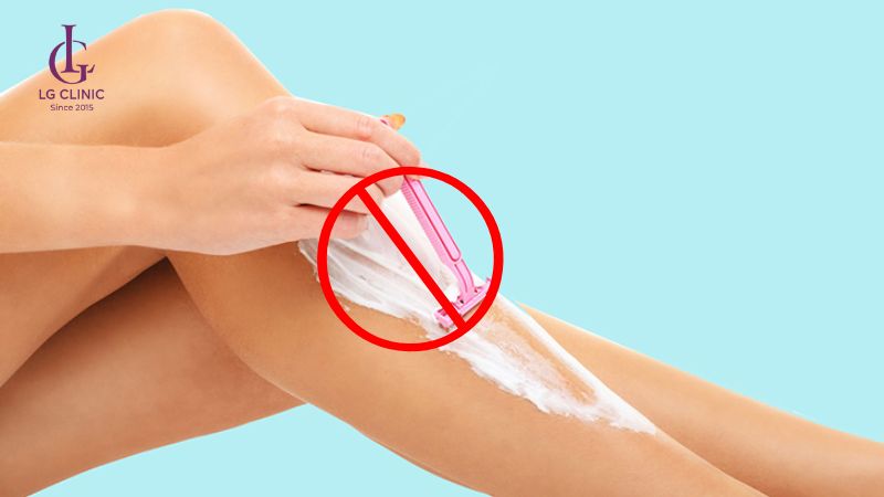 hạn chế cạo lông sau khi triệt