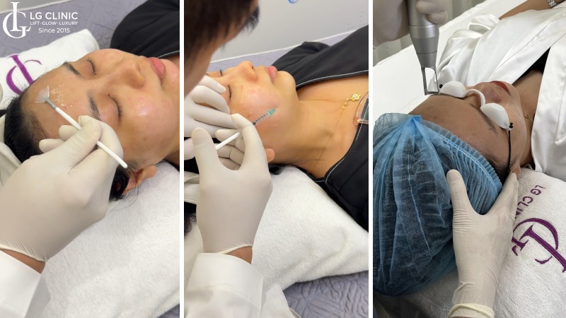 mặt nạ cà chua trị mụn thâm