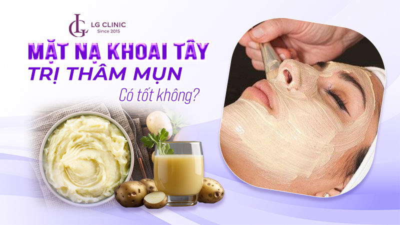 Mặt nạ khoai tây trị thâm mụn