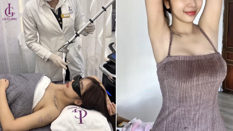 spa trị thâm bình dương