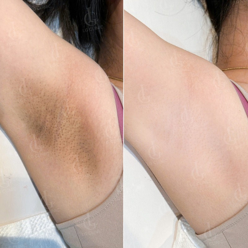 Spa trị thâm quận bình thạnh