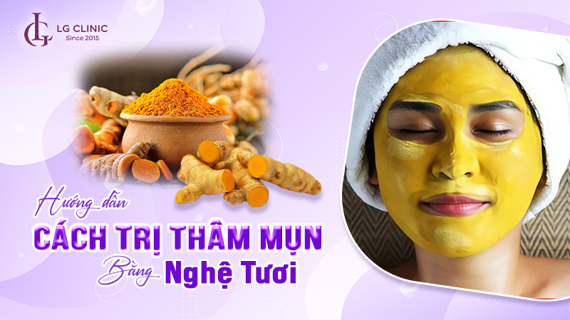 trị thâm mụn bằng nghệ tươi