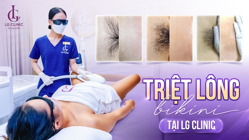 triệt lông bikini tphcm tại litle garden