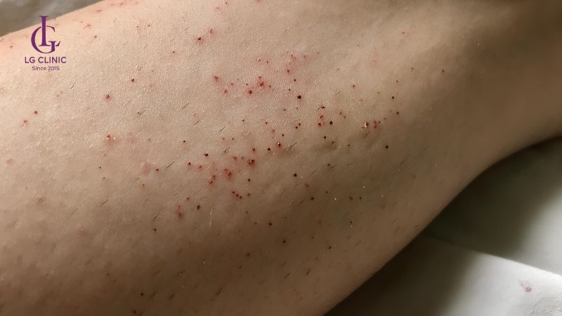cạo lông chân có thể gây tổn thương da