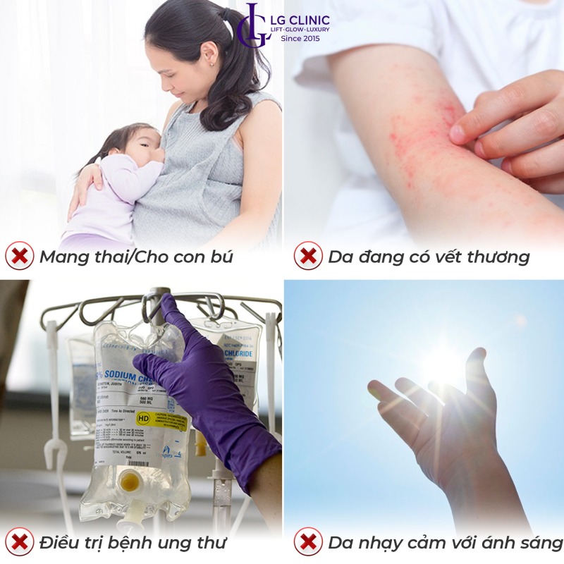 triệt lông nách vĩnh viễn