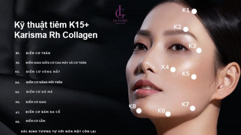 Karisma Rh Collagen