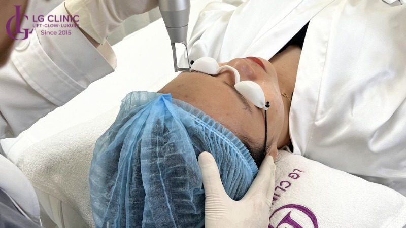 mặt nạ khoai tây trị thâm mụn