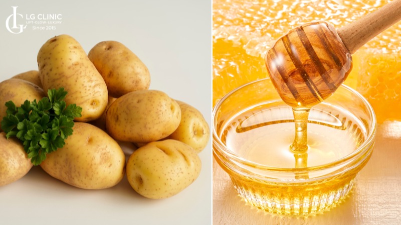 mặt nạ khoai tây trị thâm mụn