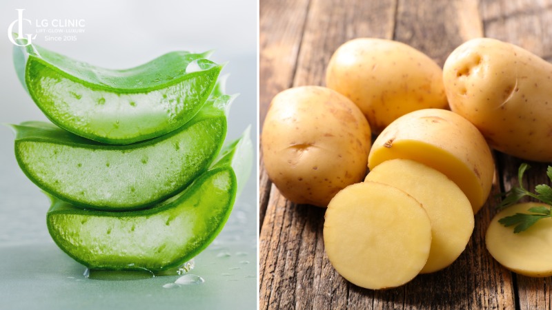 mặt nạ khoai tây trị thâm mụn