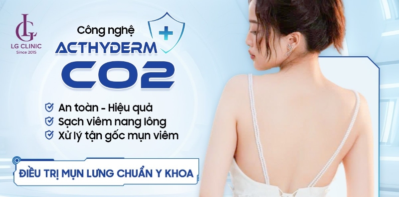 Phòng khám Da liễu trị mụn lưng bằng công nghệ Acthyderm-CO2