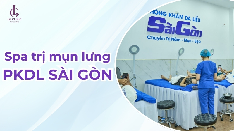Spa trị mụn lưng SGC