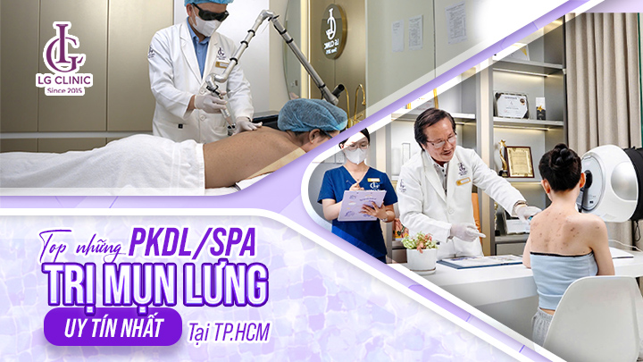 Spa trị mụn lưng