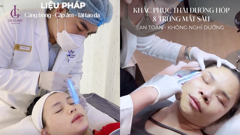 Quy trình tiêm BAP Profhilo tại LG Clinic