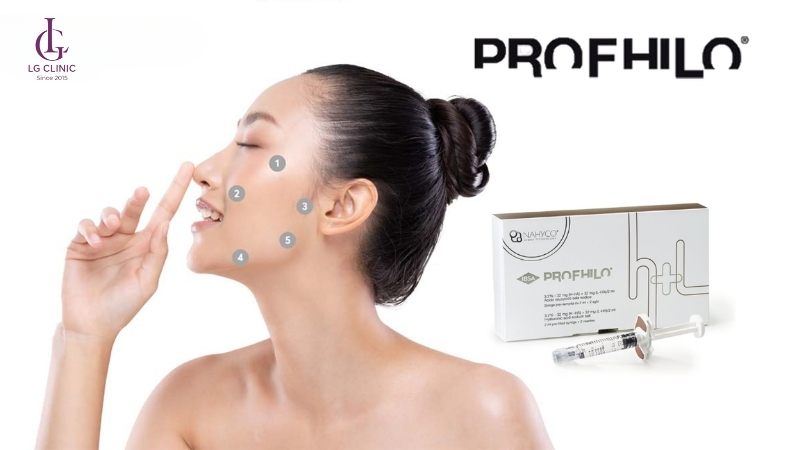 Liệu trình tiêm Profhilo