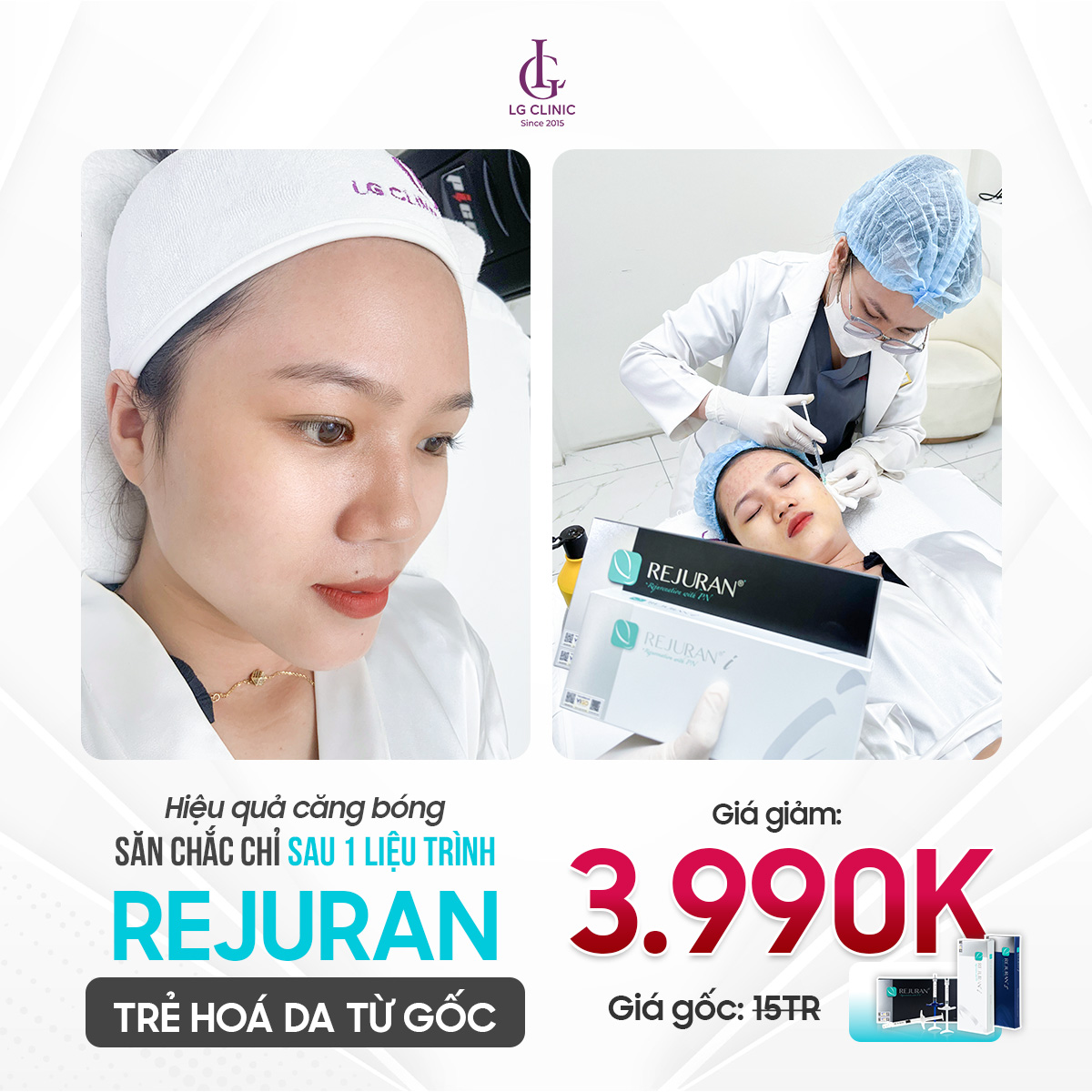 giá tiêm rejuran