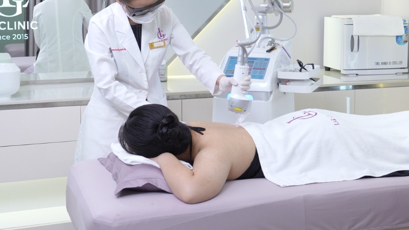 cách trị mụn lưng