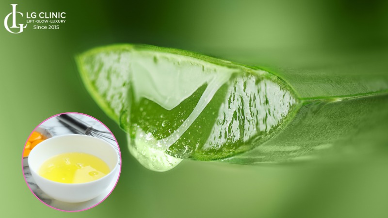 cách trị mụn thâm bằng nha đam và trứng gà