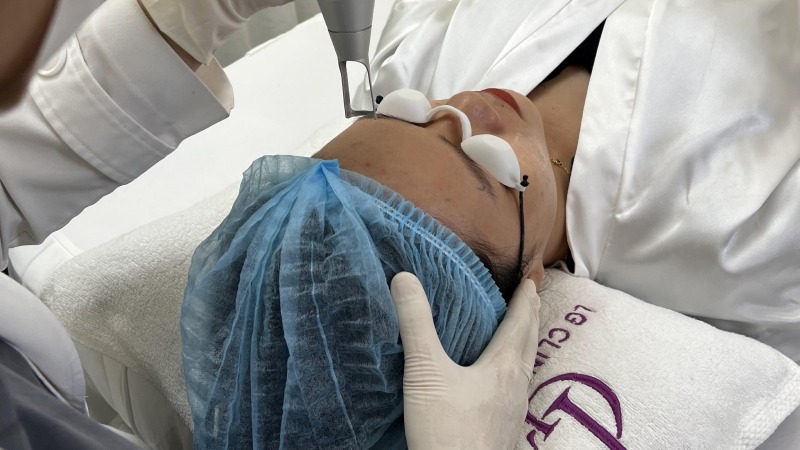 trị thâm mụn bằng tỏi