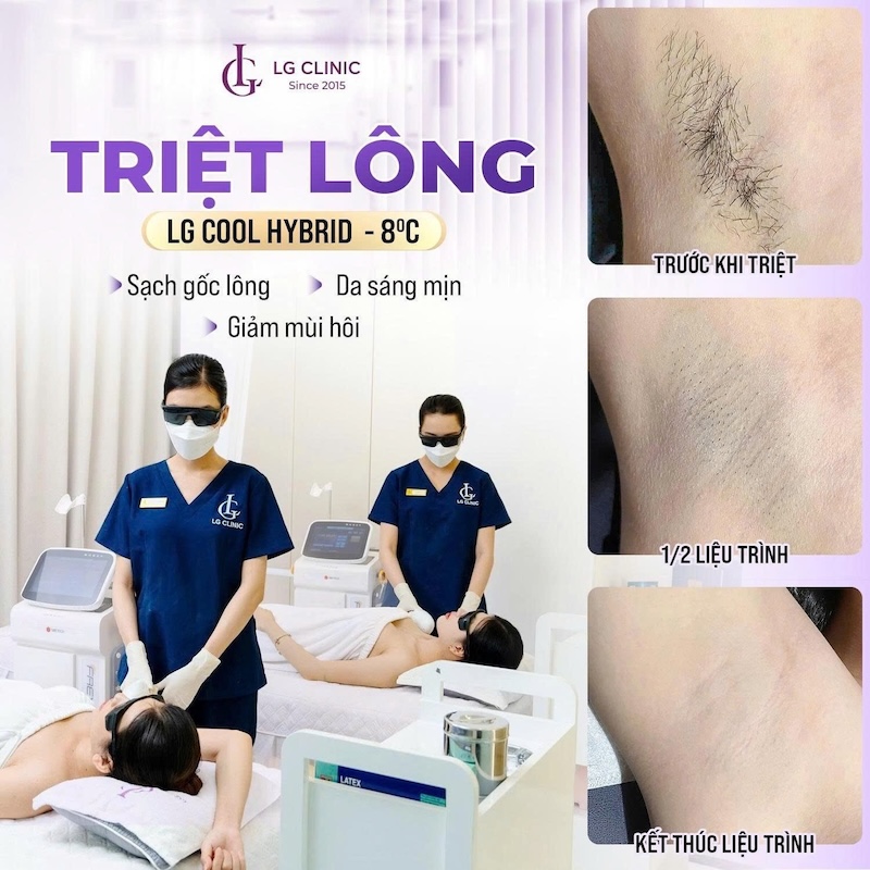 triệt lông nách vĩnh viễn tại LG Clinic