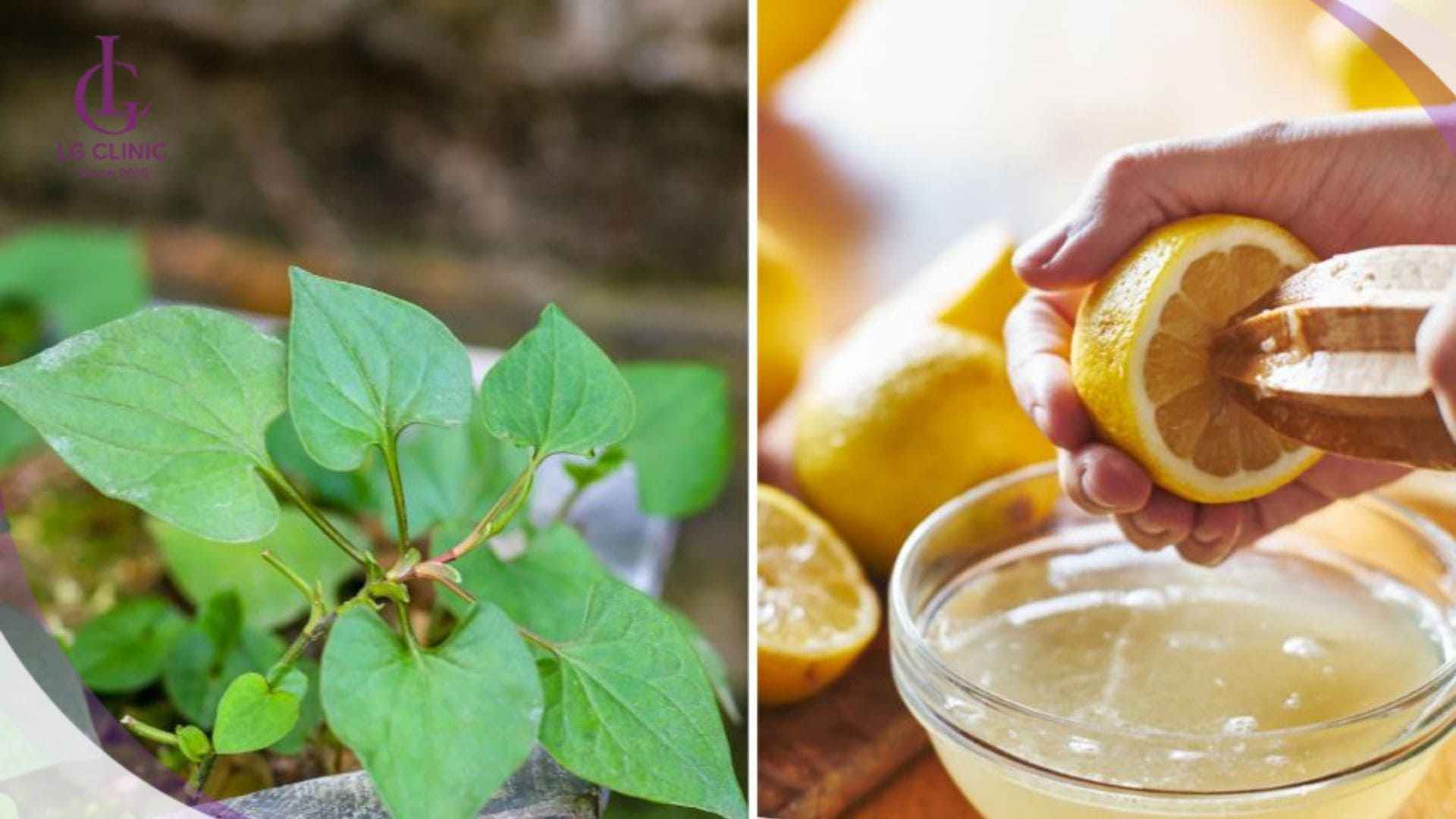 Cách làm trắng da bằng rau diếp cá và nước cốt chanh giúp da sáng mịn và đều màu tự nhiên.