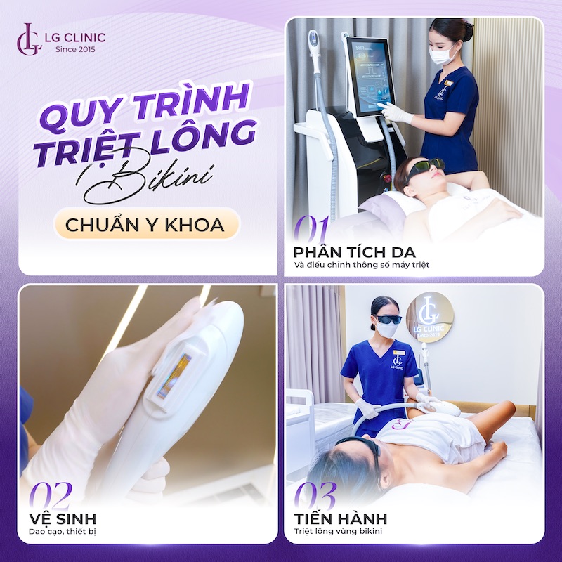 triệt lông bikini