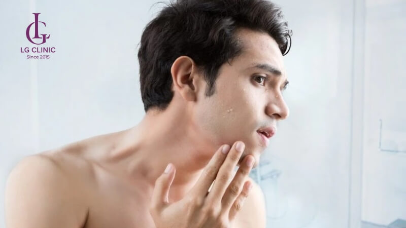 Cách làm trắng da cho nam