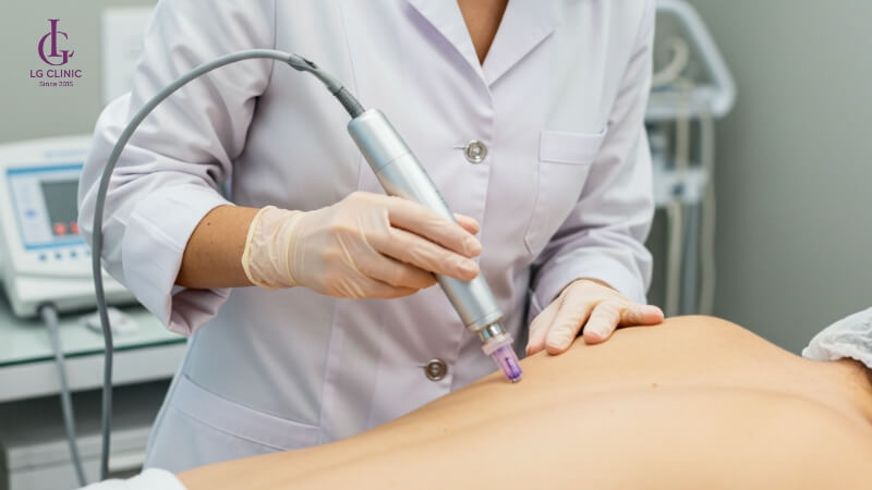 Ưu điểm của cấy trắng body