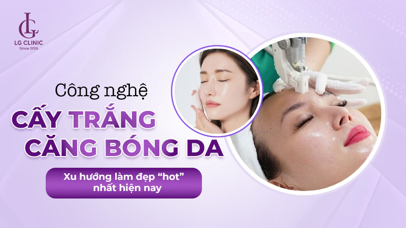 Cấy trắng căng bóng da